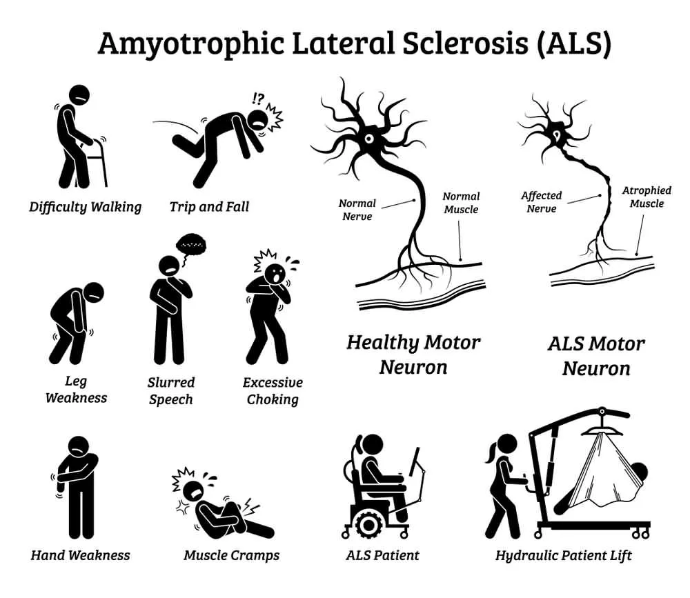 13 Early Warning Signs & Symptoms of ALS (Amyotrophic Lateral Sclerosis)