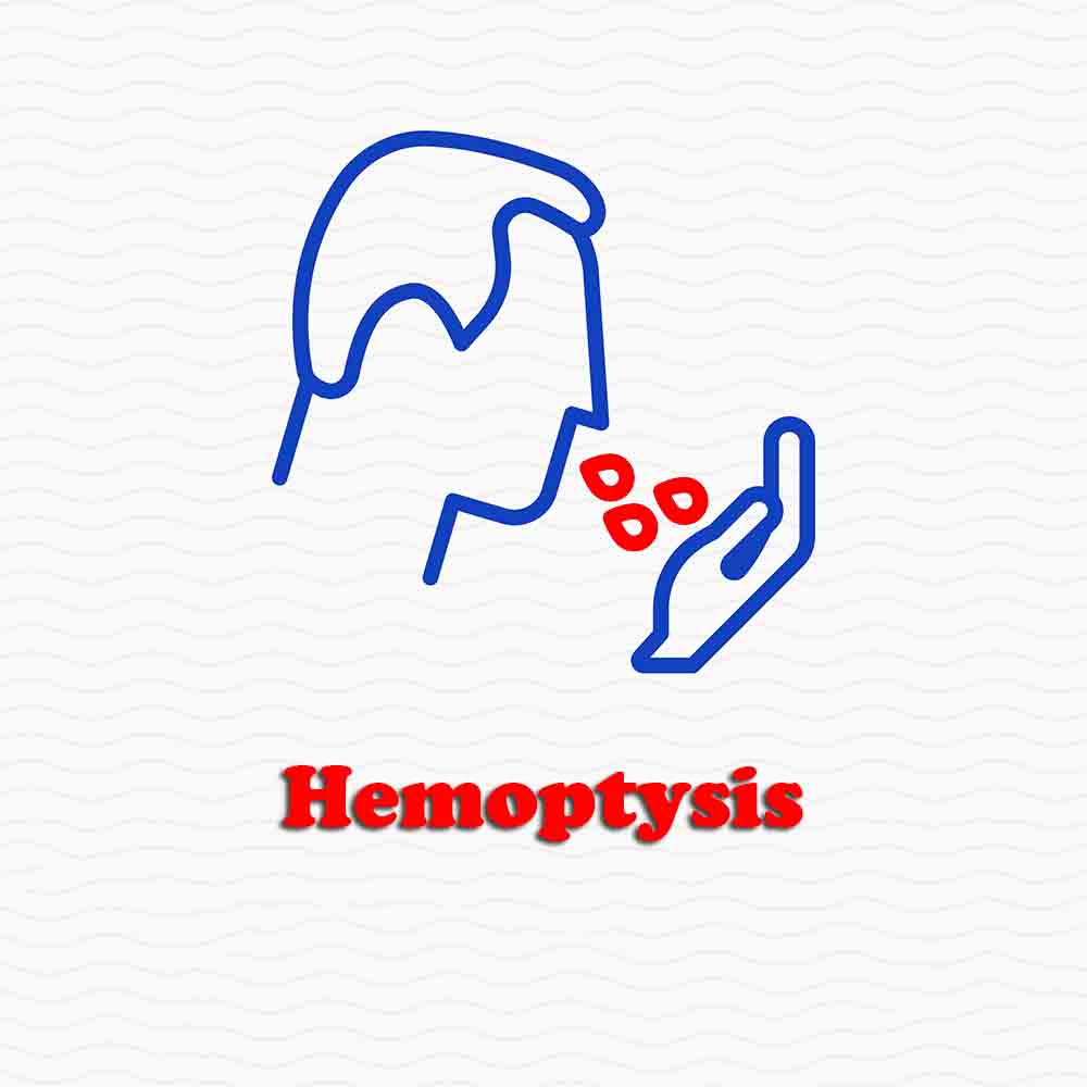 Hemoptysis, Pulmonary Embolism Symptoms