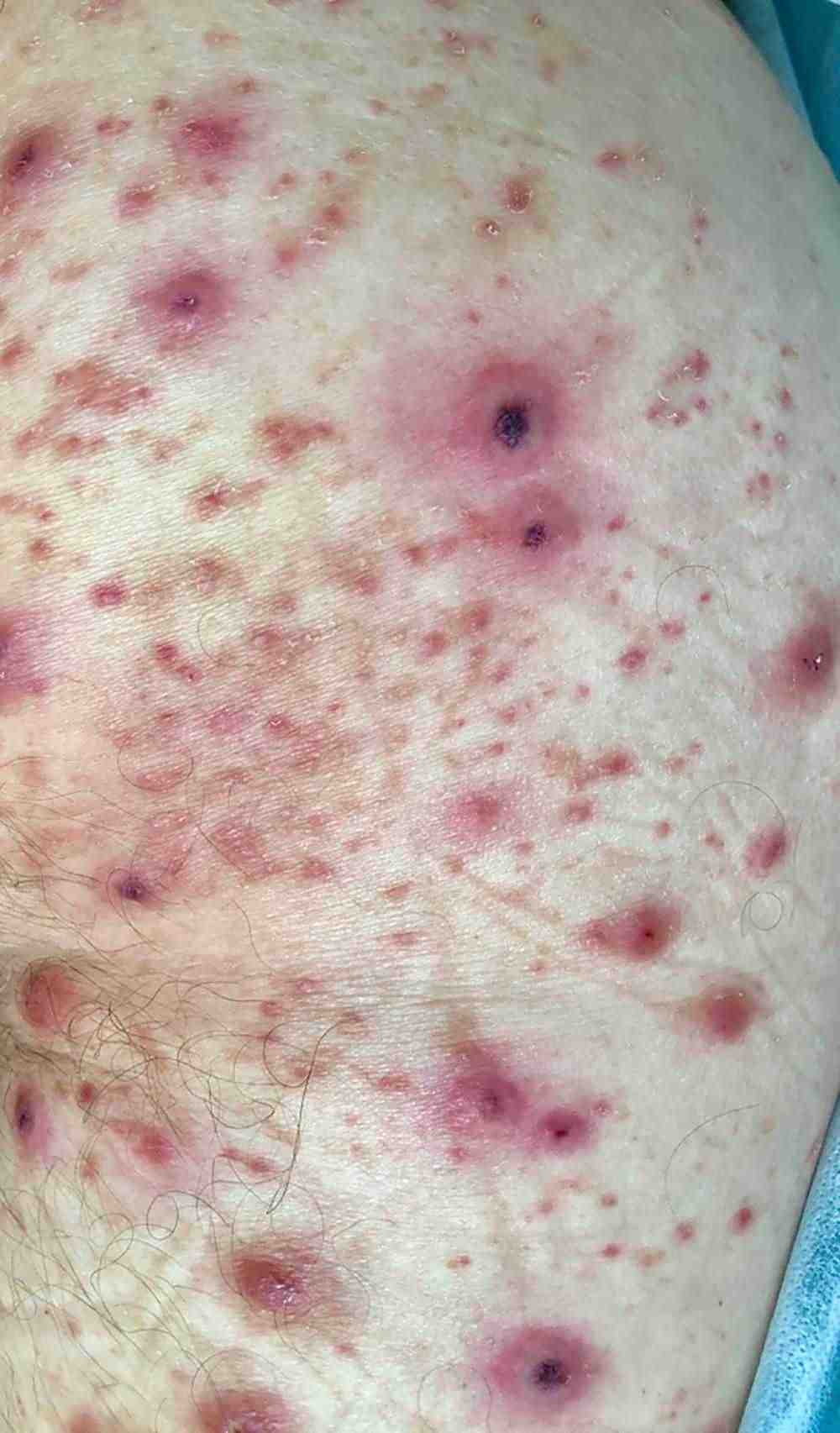 When To Worry About A Rash In Adults Healthella