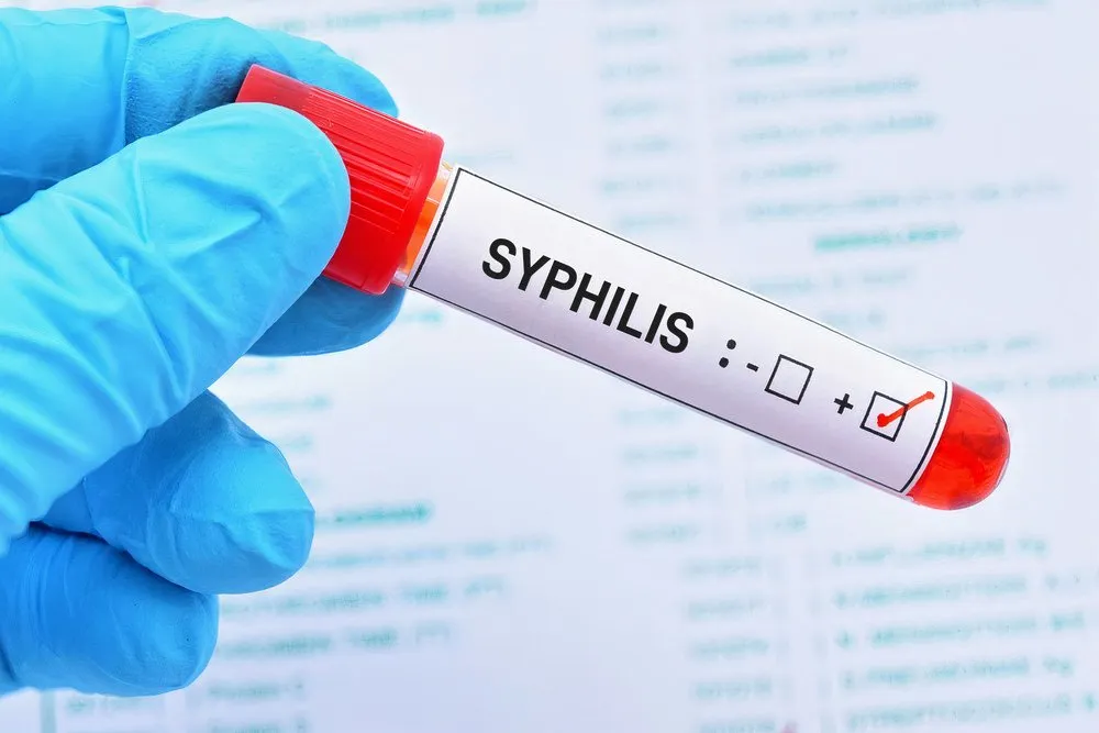 Syphilis | Stages, Symptoms, Treatment & Prevention - Healthella